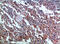 Glycoprotein Ib Platelet Subunit Beta antibody, STJ98991, St John