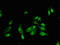 Fanconi anemia group A protein antibody, orb48200, Biorbyt, Immunocytochemistry image 