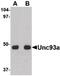 Unc-93 Homolog A antibody, PA5-20509, Invitrogen Antibodies, Western Blot image 