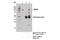 Netrin receptor UNC5B antibody, 13851S, Cell Signaling Technology, Immunoprecipitation image 