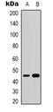 Rho GTPase Activating Protein 27 antibody, orb78401, Biorbyt, Western Blot image 
