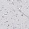 Motile Sperm Domain Containing 2 antibody, NBP1-93499, Novus Biologicals, Immunohistochemistry paraffin image 