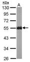 5 -AMP-activated protein kinase subunit gamma-2 antibody, TA308033, Origene, Western Blot image 