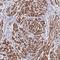 Neuroepithelial Cell Transforming 1 antibody, NBP2-13653, Novus Biologicals, Immunohistochemistry paraffin image 
