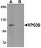 Vam6/Vps39-like protein antibody, NBP1-76535, Novus Biologicals, Western Blot image 