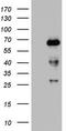 NUMB Endocytic Adaptor Protein antibody, CF802162, Origene, Western Blot image 