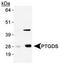 Prostaglandin D2 Synthase antibody, TA301421, Origene, Western Blot image 