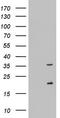 NUS1 Dehydrodolichyl Diphosphate Synthase Subunit antibody, LS-C338658, Lifespan Biosciences, Western Blot image 