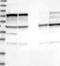 GATA binding protein 3 antibody, NBP1-83271, Novus Biologicals, Western Blot image 