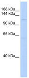 SIN3 Transcription Regulator Family Member B antibody, TA339717, Origene, Western Blot image 