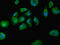 Dedicator of cytokinesis protein 8 antibody, LS-C675652, Lifespan Biosciences, Immunofluorescence image 