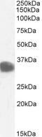 Carbonyl Reductase 1 antibody, TA302807, Origene, Western Blot image 