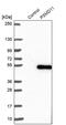Proteasome 26S Subunit, Non-ATPase 11 antibody, PA5-59933, Invitrogen Antibodies, Western Blot image 