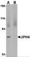 Junctophilin 4 antibody, 4923, ProSci Inc, Western Blot image 