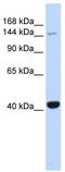 Janus Kinase 3 antibody, TA336238, Origene, Western Blot image 