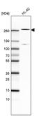 Methylcytosine dioxygenase TET2 antibody, AMAb91439, Atlas Antibodies, Western Blot image 