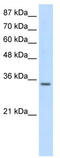 Small Nuclear Ribonucleoprotein Polypeptide A antibody, TA345885, Origene, Western Blot image 