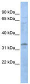 Protein lyl-1 antibody, TA330049, Origene, Western Blot image 