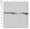 Chaperonin Containing TCP1 Subunit 2 antibody, M05524, Boster Biological Technology, Western Blot image 