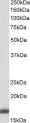 Ribosomal Protein S19 antibody, NB100-2452, Novus Biologicals, Western Blot image 