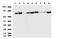 Ribonucleotide Reductase Catalytic Subunit M1 antibody, UM800059, Origene, Western Blot image 