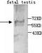 Anti-Mullerian Hormone antibody, TA310102, Origene, Western Blot image 