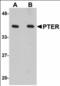 Phosphotriesterase Related antibody, orb89833, Biorbyt, Western Blot image 