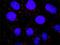 Protein Tyrosine Phosphatase Non-Receptor Type 11 antibody, H00005781-B02P, Novus Biologicals, Proximity Ligation Assay image 