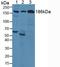 Complement component C3c antibody, LS-C293472, Lifespan Biosciences, Western Blot image 