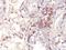 Melanoma-associated antigen 1 antibody, orb388416, Biorbyt, Immunohistochemistry paraffin image 