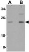 Calcium-binding protein 7 antibody, GTX85169, GeneTex, Western Blot image 