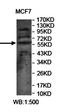 YES Proto-Oncogene 1, Src Family Tyrosine Kinase antibody, orb78455, Biorbyt, Western Blot image 