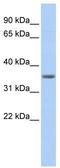 Pyruvate Dehydrogenase E1 Beta Subunit antibody, TA346540, Origene, Western Blot image 