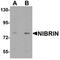 Hedgehog Acyltransferase Like antibody, orb75776, Biorbyt, Western Blot image 