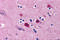 Bcl-2-related ovarian killer protein antibody, 3357, ProSci, Immunohistochemistry frozen image 