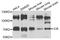 Serine/threonine-protein kinase ICK antibody, STJ110093, St John