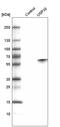 Ubiquitin Specific Peptidase 30 antibody, AMAb91295, Atlas Antibodies, Western Blot image 