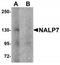 NACHT, LRR and PYD domains-containing protein 7 antibody, TA320136, Origene, Western Blot image 