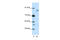 Leucine Zipper Like Transcription Regulator 1 antibody, 28-956, ProSci, Enzyme Linked Immunosorbent Assay image 