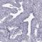 Chromosome 7 Open Reading Frame 61 antibody, HPA060395, Atlas Antibodies, Immunohistochemistry paraffin image 
