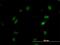 Serine/threonine-protein kinase OSR1 antibody, H00009943-M16, Novus Biologicals, Immunocytochemistry image 