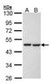 KRR1 Small Subunit Processome Component Homolog antibody, GTX105761, GeneTex, Western Blot image 