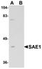 SUMO1 Activating Enzyme Subunit 1 antibody, TA326603, Origene, Western Blot image 