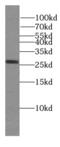 Linker For Activation Of T Cells Family Member 2 antibody, FNab09476, FineTest, Western Blot image 