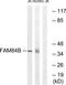 LRAT Domain Containing 2 antibody, TA312562, Origene, Western Blot image 