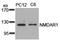 Glutamate Ionotropic Receptor NMDA Type Subunit 1 antibody, AP08051PU-S, Origene, Western Blot image 