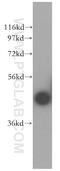 Carbonic Anhydrase 14 antibody, 13736-1-AP, Proteintech Group, Western Blot image 