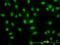 DEAD-Box Helicase 56 antibody, H00054606-M05, Novus Biologicals, Immunofluorescence image 