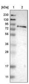 Ferric Chelate Reductase 1 antibody, PA5-53655, Invitrogen Antibodies, Western Blot image 
