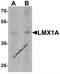 LIM Homeobox Transcription Factor 1 Alpha antibody, 7087, ProSci, Western Blot image 